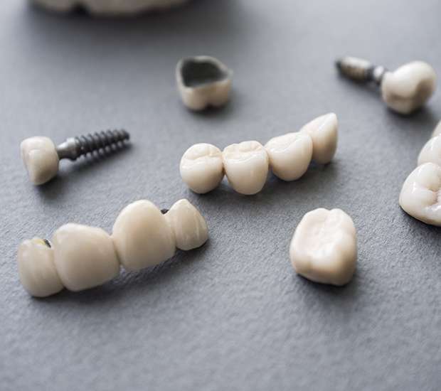 Chapel Hill The Difference Between Dental Implants and Mini Dental Implants